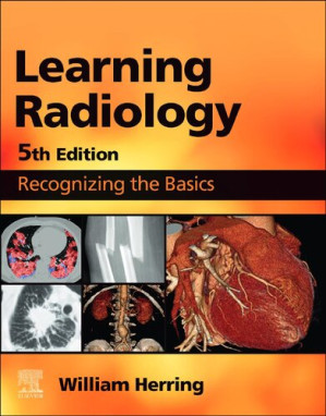 Learning Radiology cover