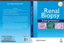 Renal Biopsy Interpretation